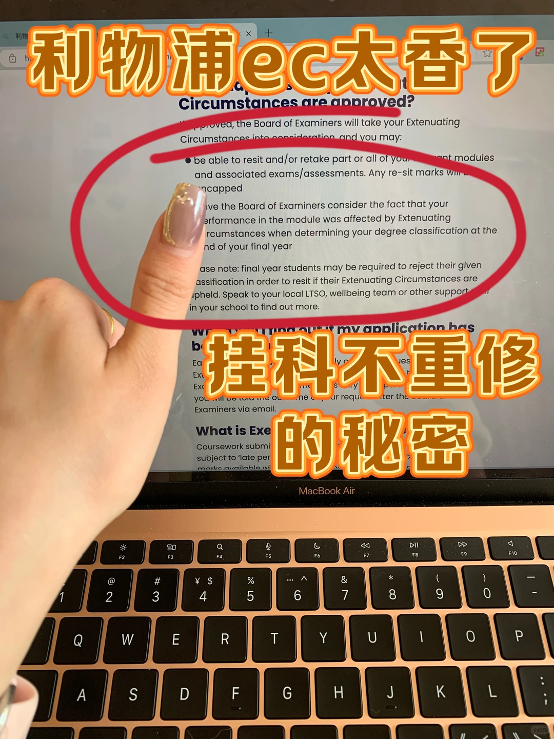 利物浦EC用处真大！考后上保险（附diy教程 — 内容图片 1