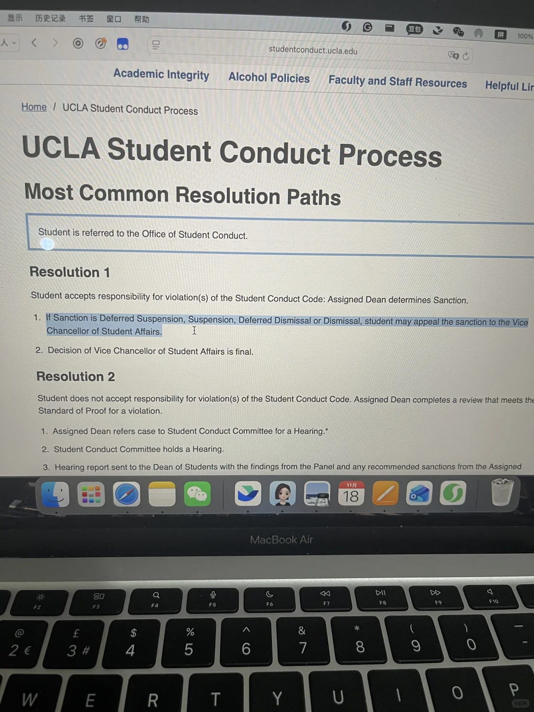 在ucla打了同学一耳光，听证会后被停学 — 内容图片 2